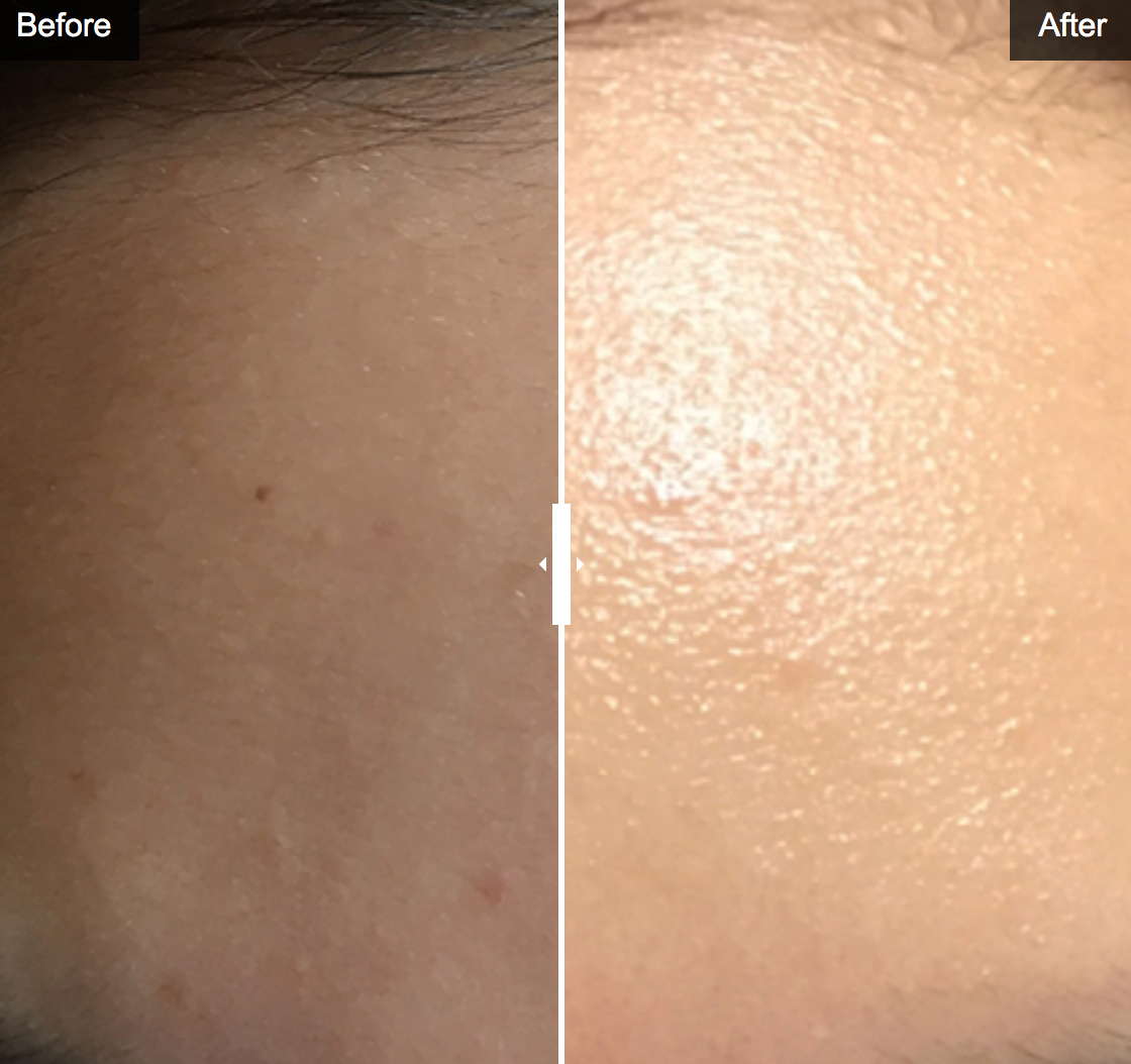 Jet Plus Brightening Facial Dual Mask