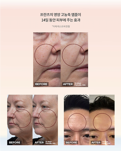 STEM CELL CULTURE MEDIUM AMPOULE 10%